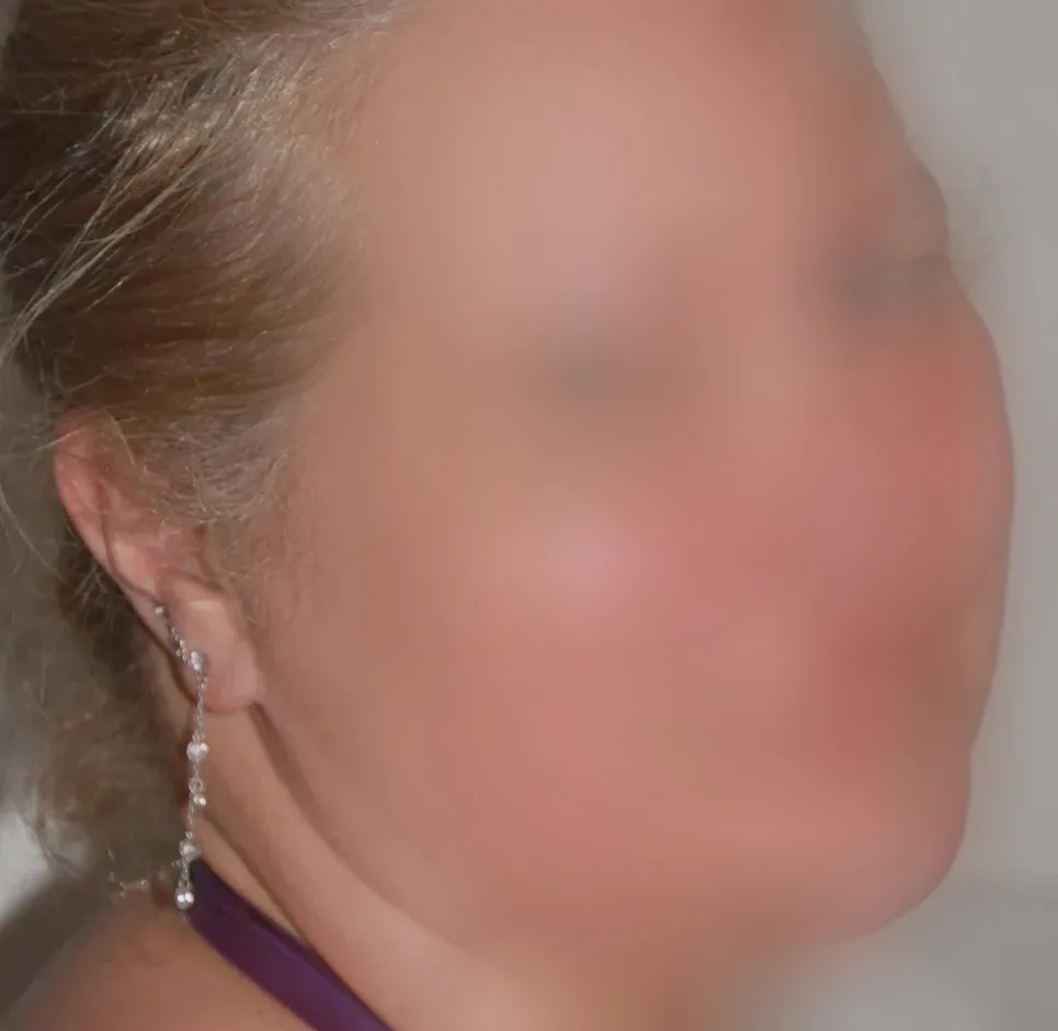 Lotta, 28